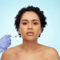 Botox treatment