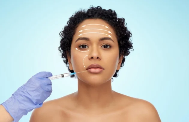 Botox treatment
